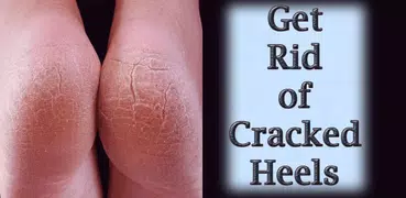 Get Rid of Cracked Heels