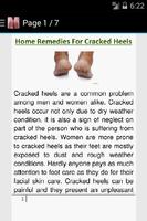 Get Rid of Cracked Heels تصوير الشاشة 2