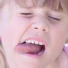 Burning Tongue أيقونة