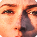 Get Rid Dark Spot On Skin-APK
