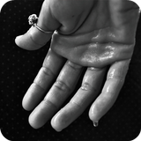 Excessive Sweating Treatment أيقونة