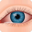 Eye Infections Home Remedies