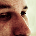 Large Pores Home Remedies