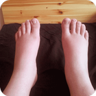 Swelling Feet Home Remedies icône