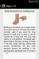 Swelling Feet Home Remedies تصوير الشاشة 2