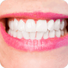 How to Whiten Teeth Instantly أيقونة