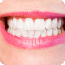 How to Whiten Teeth Instantly APK