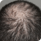 Hair Fall Home Remedies 图标