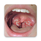 Tonsils Home Remedy icône