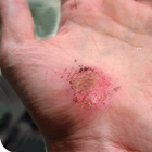 Abrasions Home Remedies 圖標