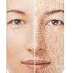 ”Dry Skin Causes and Solutions