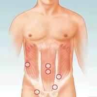 Hernia Home Remedies 海報