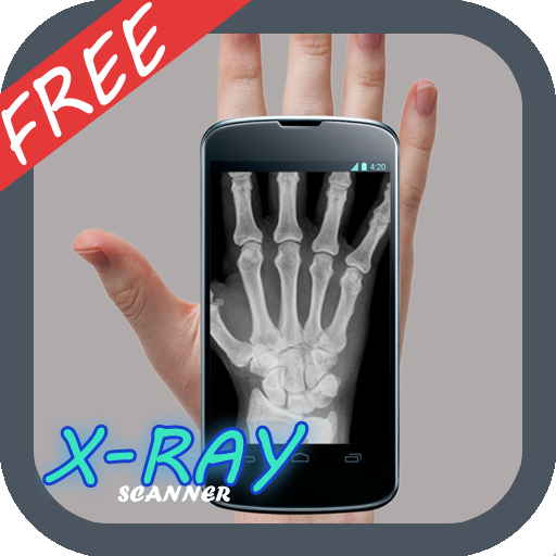 Xray Scan Prank