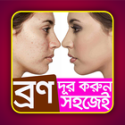 ব্রণ দূর করুন সহজেই - Bron dur korun shohoja icono