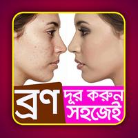 ব্রণ দূর করুন সহজেই - Bron dur korun shohoja poster