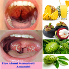 Natural Tips To Treat Tonsil icône