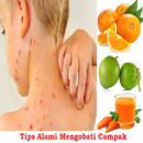 Natural Tips To Treat Measles APK