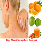 Natural Tips To Treat Measles icône