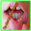 Natural Tips Treat Thrush