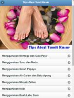 Tips Atasi Tumit Kasar poster