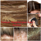 Cara Menghilangkan Kutu Rambut иконка