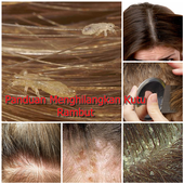 Cara Menghilangkan Kutu Rambut icon