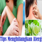 Eliminate Allergy Tips آئیکن