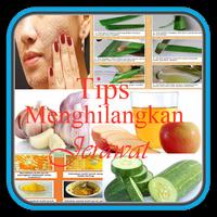 Tips Menghilangkan Jerawat Affiche