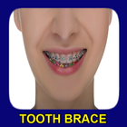 Tooth Brace Ideas icône