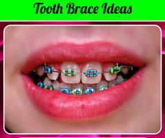 برنامه‌نما Tooth Brace Ideas عکس از صفحه