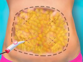 Live Surgery Simulator اسکرین شاٹ 1