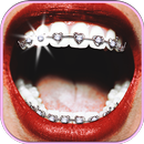Fake Braces for Teeth App – Funny Photo Booth APK
