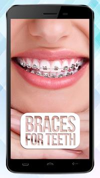 fake braces for teeth app funny photo booth for android apk download