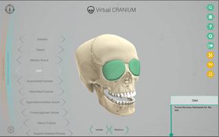 Virtual Cranium स्क्रीनशॉट 1