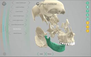 Virtual Cranium स्क्रीनशॉट 2
