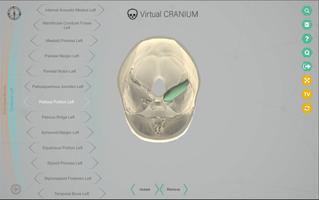 Virtual Cranium स्क्रीनशॉट 3