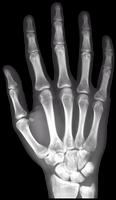 X-Ray tangan kanan gratis screenshot 1
