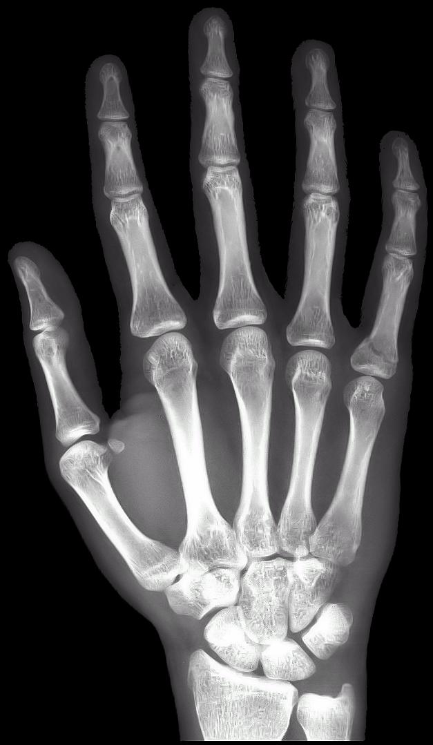 x ray right hand free for android apk download