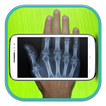 Radiographie X-ray Scanner