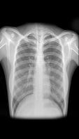 Radiographie X-ray Scanner capture d'écran 3