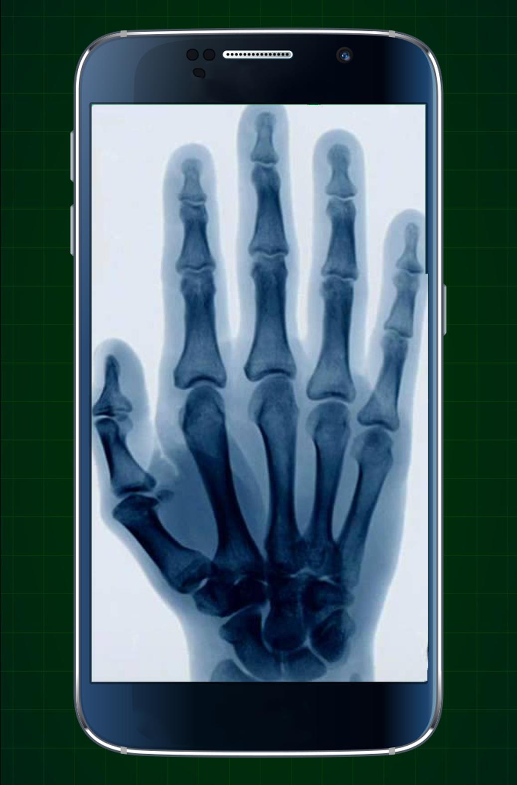 Xray Scanner Doctor For Android Apk Download - roblox xray