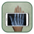 Mobile X-ray Scanner