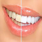 خلطات تبييض الأسنان biểu tượng