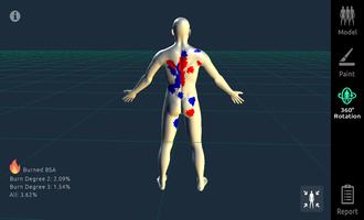 3D Burn Resuscitation capture d'écran 2