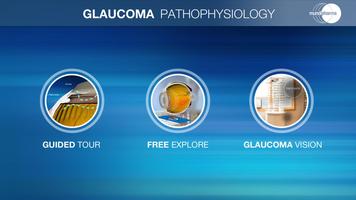 Glaucoma Education syot layar 1