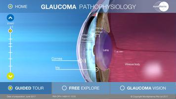 برنامه‌نما Glaucoma Education عکس از صفحه