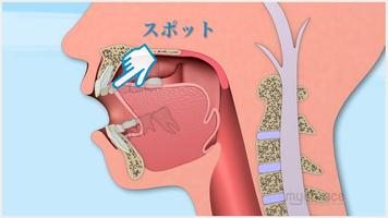 マイオブレース・アクティビティーズ syot layar 2