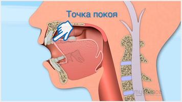 Упражнения Myobrace capture d'écran 2