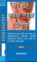 برنامه‌نما ব্রণ দুর করার সহজ উপায় عکس از صفحه