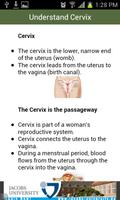 Cervical Cancer 截图 1